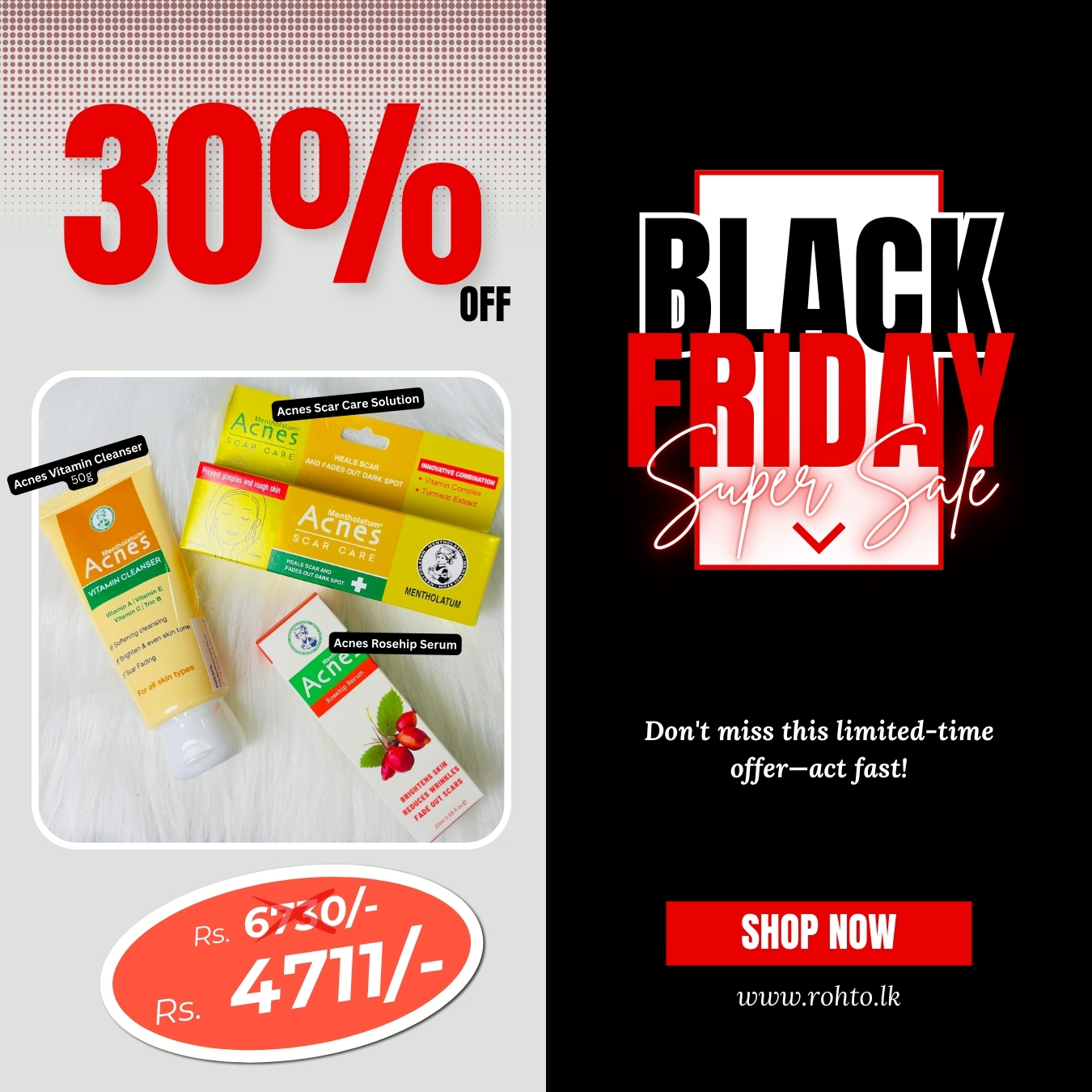 Acnes Bundle offer 1